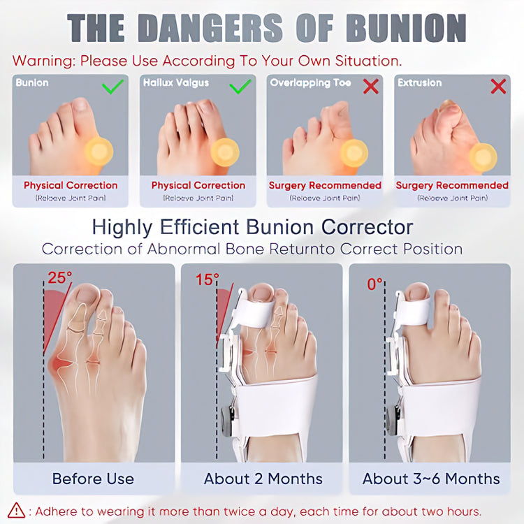 Bunion Corrector For Women, Foot Thumb Support Foot Adjustable Toe Thumb Straightener Corrector